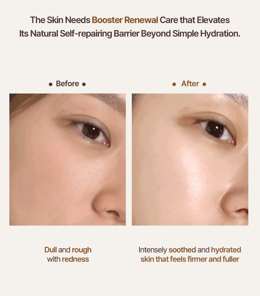 Heveblue Salmon Caring Newpair PDRN Booster 100,000 Shot Essence 5 ml — manufacturer before-and-after skin images.