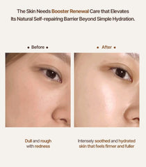 Heveblue Salmon Caring Newpair PDRN Booster 100,000 Shot Essence 5 ml — manufacturer before-and-after skin images.