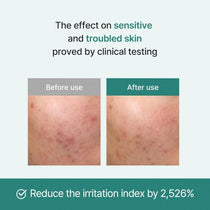 I'm From Licorice Calming Cream — manufacturer clinical results illustration