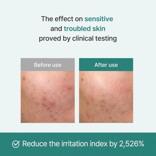 I'm From Licorice Calming Cream — manufacturer clinical results illustration