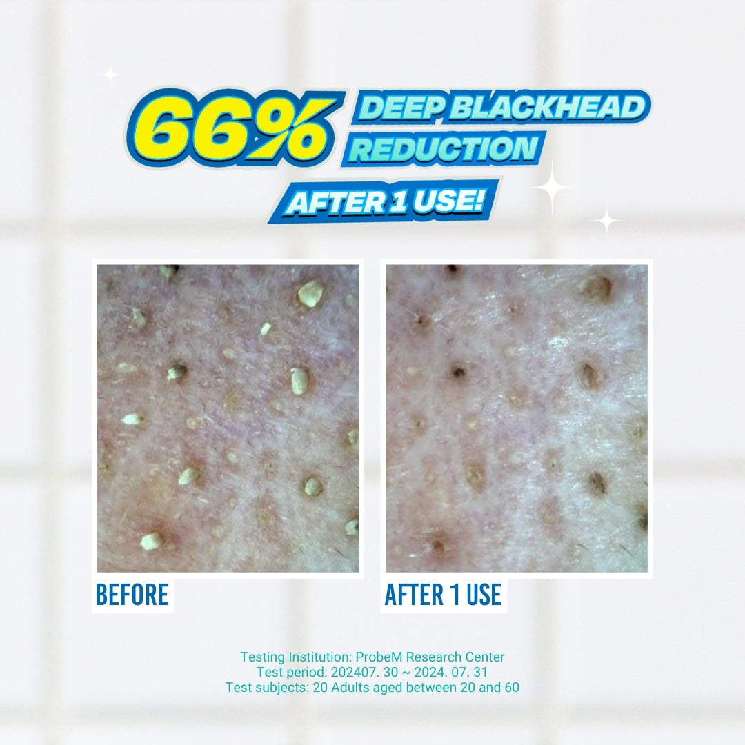 Blackhead Melting Softner Toner 150ml — official gallery view 3