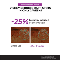Niacinamide 20% Serum — official gallery view 6
