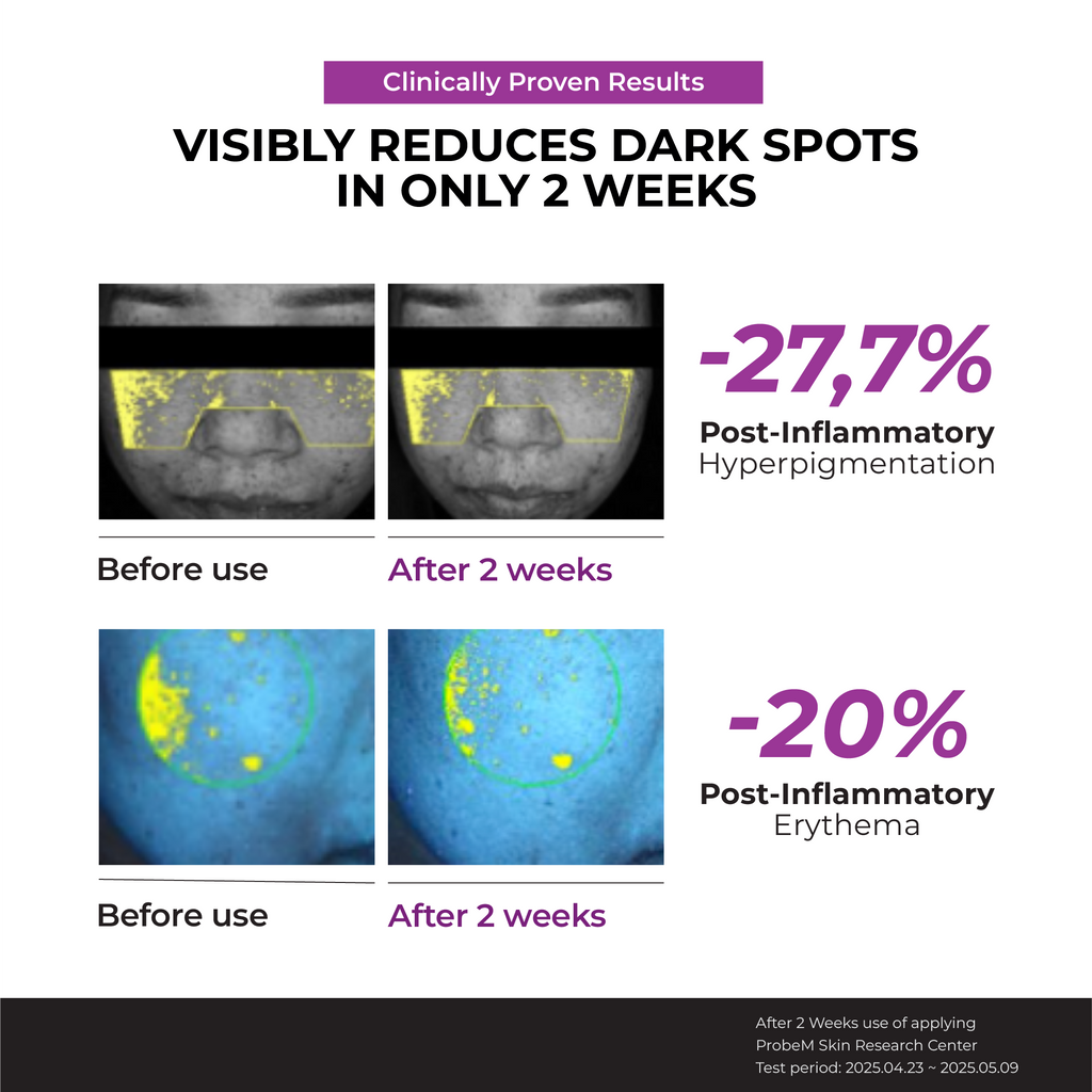 Niacinamide 20% Serum — official gallery view 7