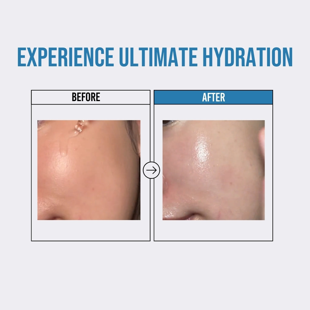Waterfull Hyaluronic Acid Serum 50ml — official gallery view 3