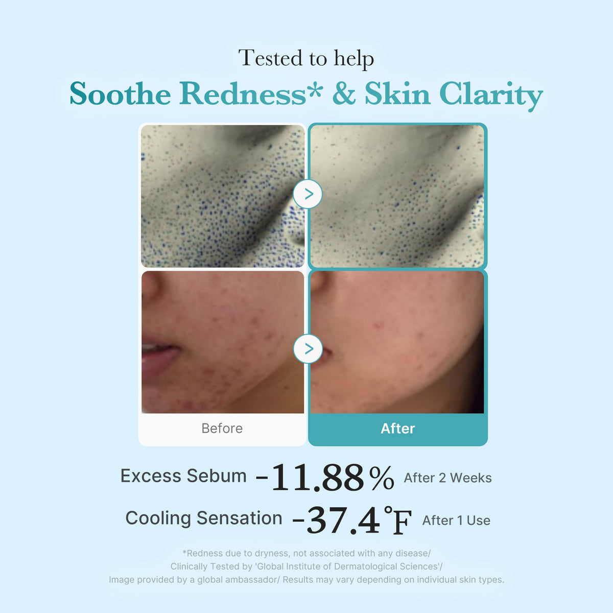 Medicube Azelaic Acid Niacinamide Clear Toner 4% — Official gallery 4