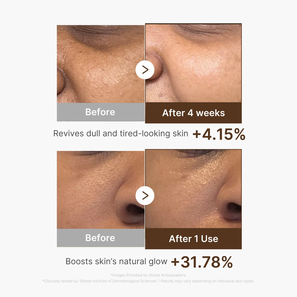 Medicube Deep Vita C Capsule Serum — Official gallery 5