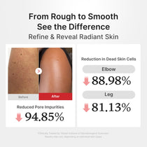 Medicube Hypochlorous Acid Body Peel Shot — Official gallery 4