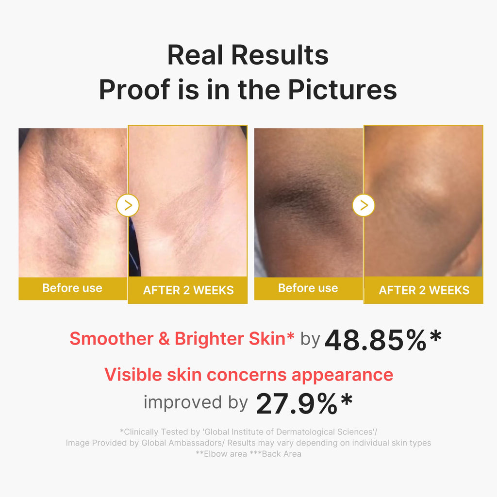 Medicube Kojic Acid Turmeric Body Peel Shot — Official gallery 3
