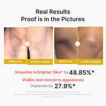 Medicube Kojic Acid Turmeric Body Peel Shot — Official gallery 3