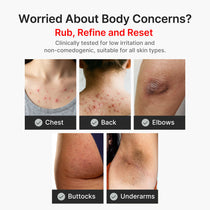Medicube Kojic Acid Turmeric Body Peel Shot — Official gallery 5