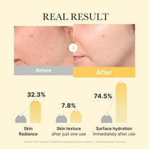 Medicube Kojic Acid Turmeric Gel Mask — Official gallery 3