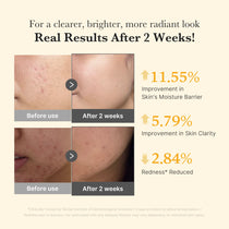 Medicube Kojic Acid Turmeric Niacinamide Serum — Official gallery 4