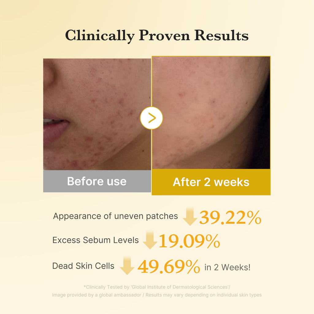 Medicube Kojic Acid Turmeric Pad — Official gallery 4