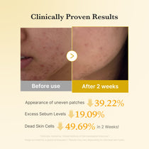 Medicube Kojic Acid Turmeric Pad — Official gallery 4