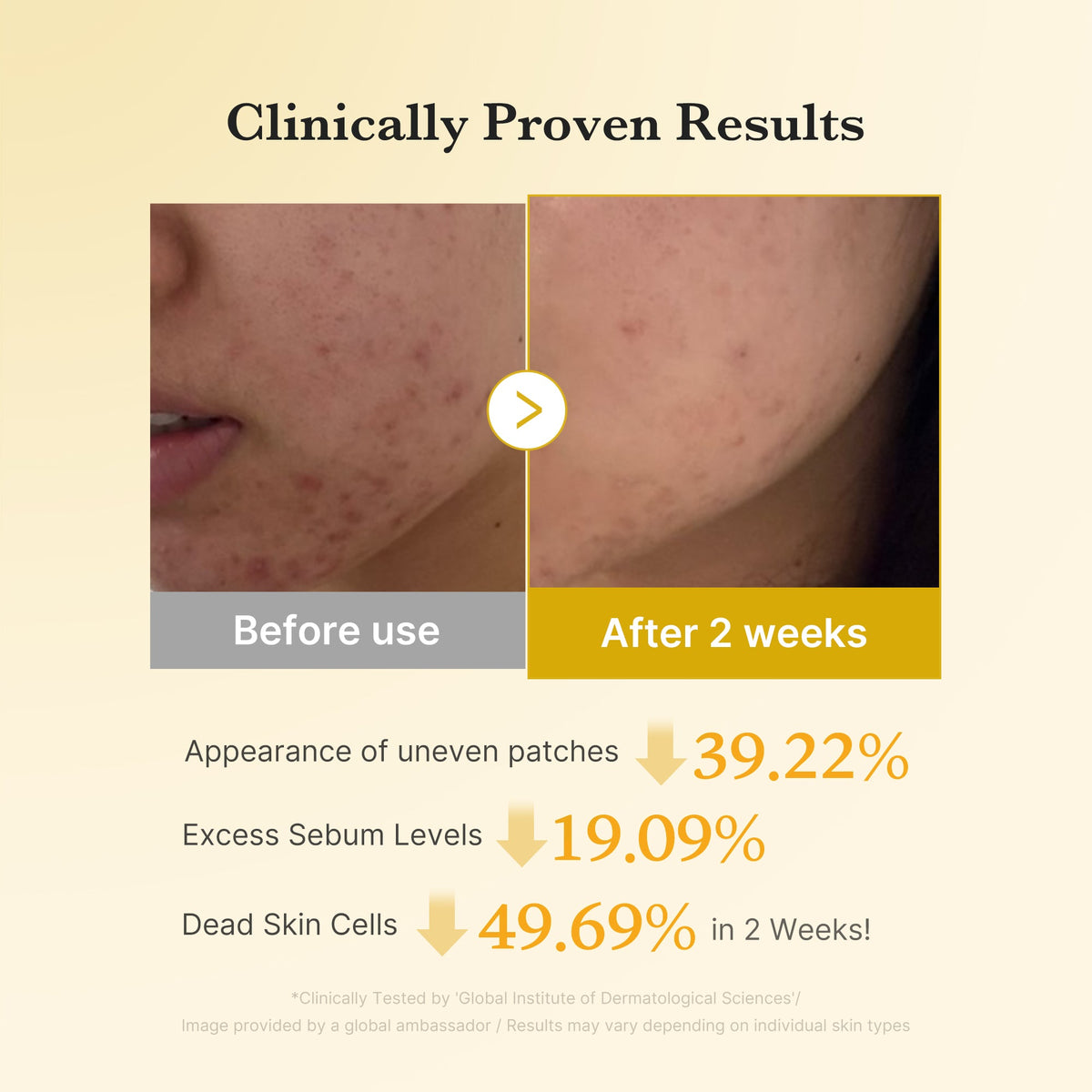 Medicube Kojic Acid Turmeric Pad — Official gallery 4