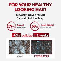 Kundal Natural Caffeine Hair Care Shampoo White Musk - official gallery 4