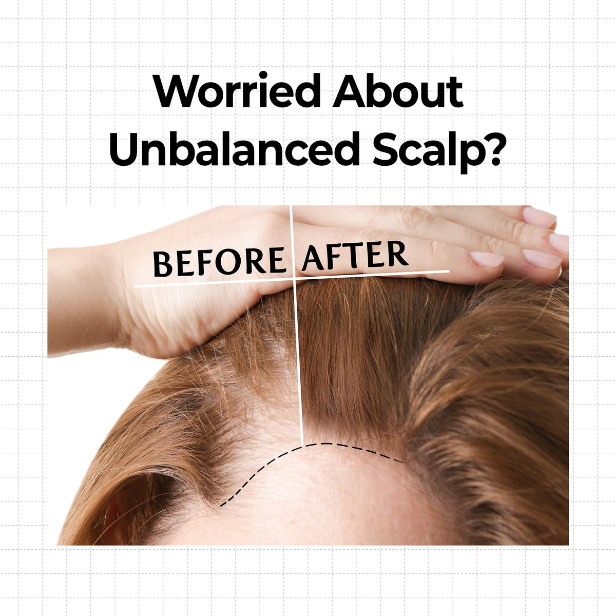 Kundal 10X Caffeine Strengthening Scalp Serum - official gallery 4