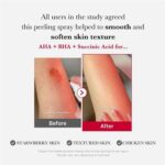 MEDICUBE Red Acne Body Peeling Shot 2.0 110g