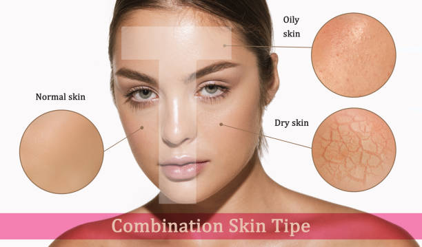 Skin Type Guide Skin Type Guide