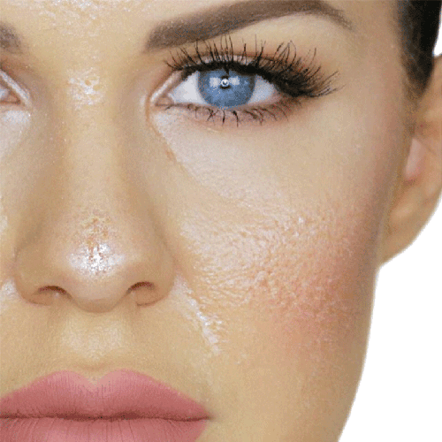 Skin Type Guide Skin Type Guide
