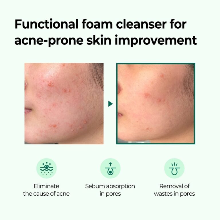 SOME BY MI AHA.BHA.PHA 30 Days Miracle Foam 100ml