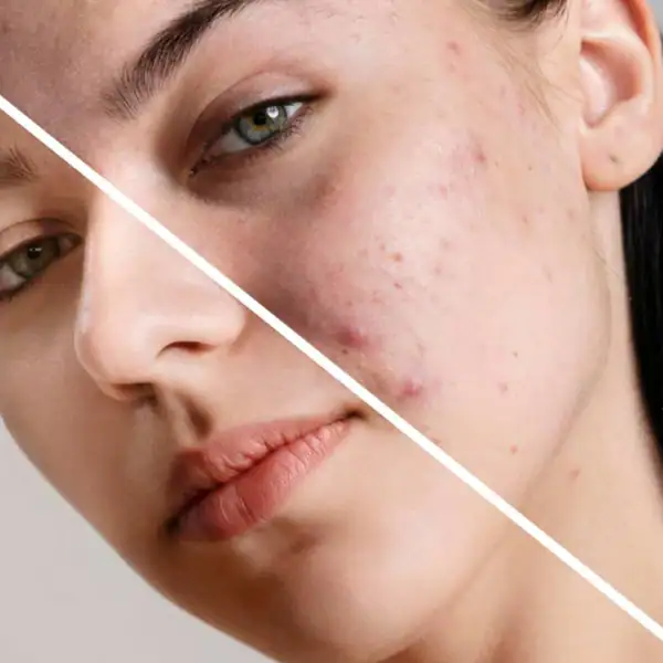 Skin Type Guide Skin Type Guide