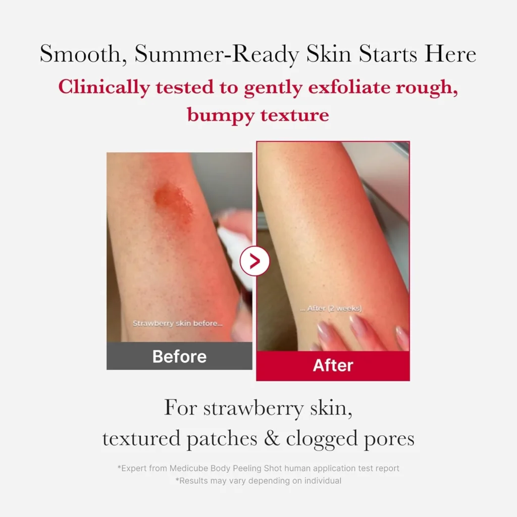 Medicube Red Acne Body Peeling Shot 2.0 110G