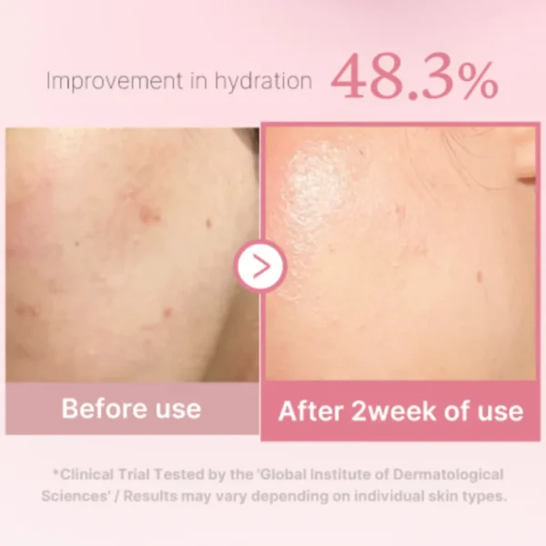 Medicube Pdrn Pink Niacinamide Milky Toner 150Ml