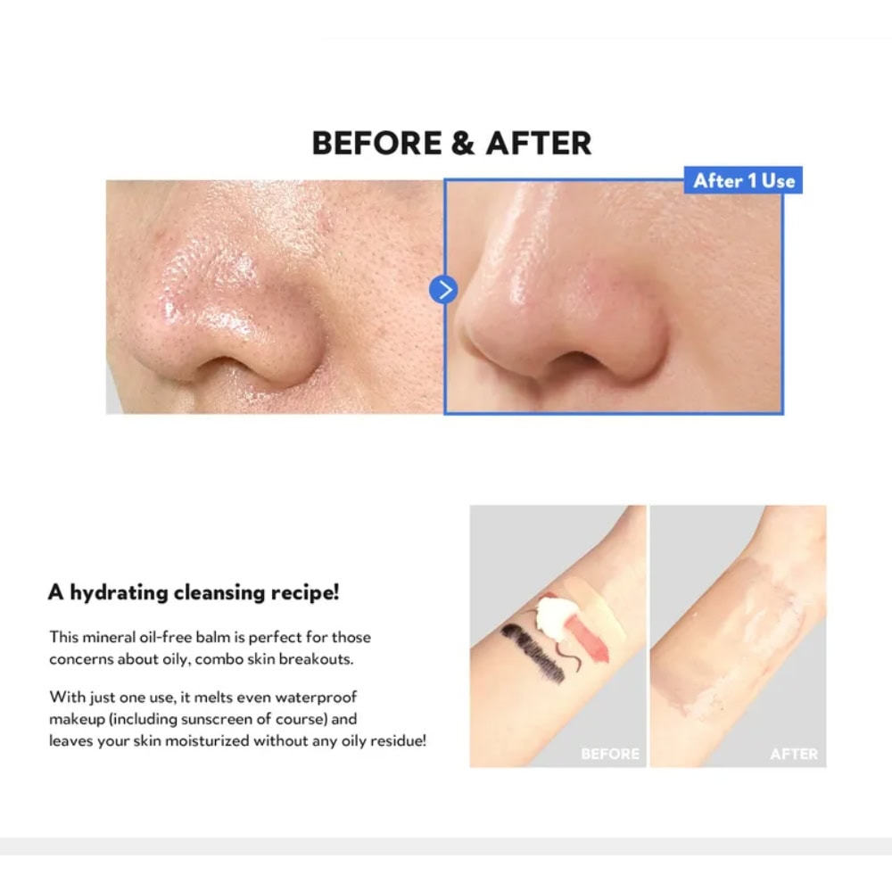 Untitled-Design-22.Jpg Tirtir Hydro Boost Enzyme Cleansing Balm 120Ml - Image 2