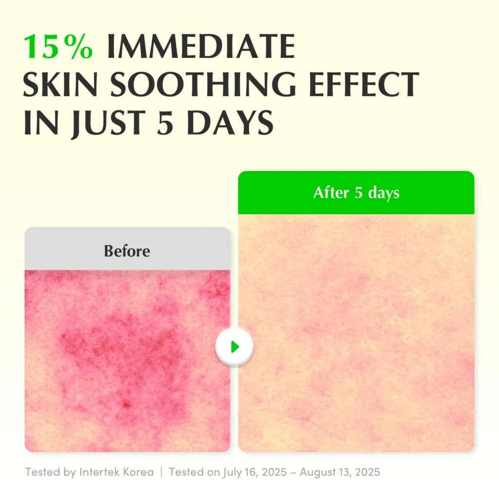 New Buy Online At K-Beauty Shine Eqqualberry Aloe Pdrn Calming Smoothie Serum 30Ml