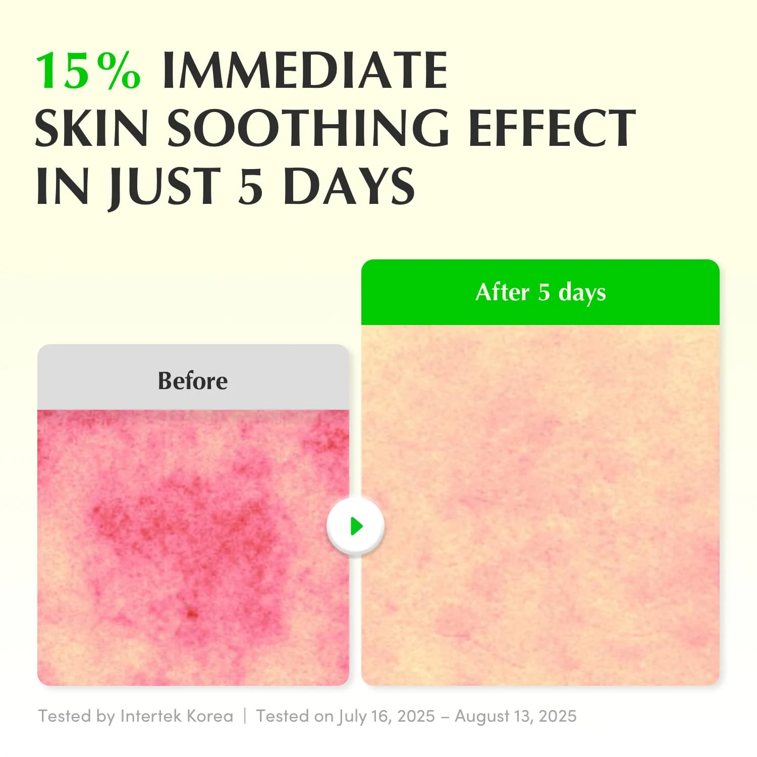 Eqqualberry Aloe Pdrn Calming Smoothie Serum 30Ml Buy Online At K-Beauty Shine Eqqualberry Aloe Pdrn Calming Smoothie Serum 30Ml