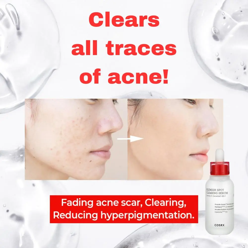 COSRX AC Collection Blemish Spot Clearing Serum 40ml