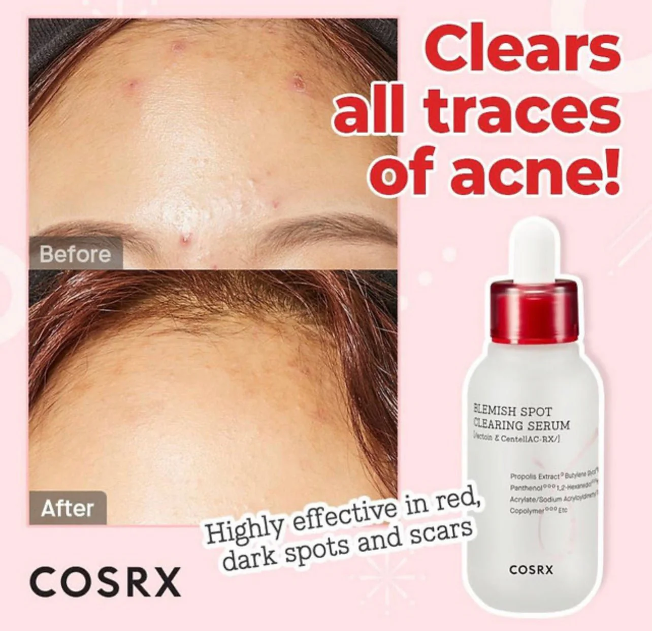COSRX AC Collection Blemish Spot Clearing Serum 40ml