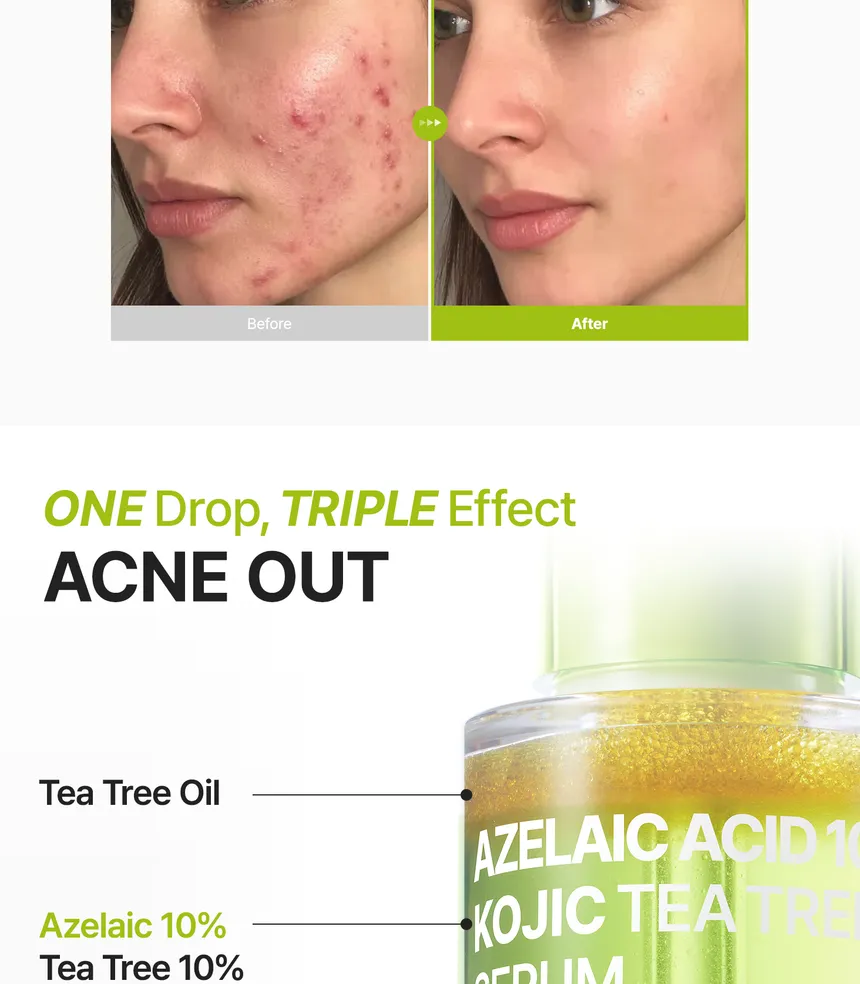 New Buy Online At K-Beauty Shine Purito Seoul Azelaic Acid 10 Kojic Azulene Serum 30Ml