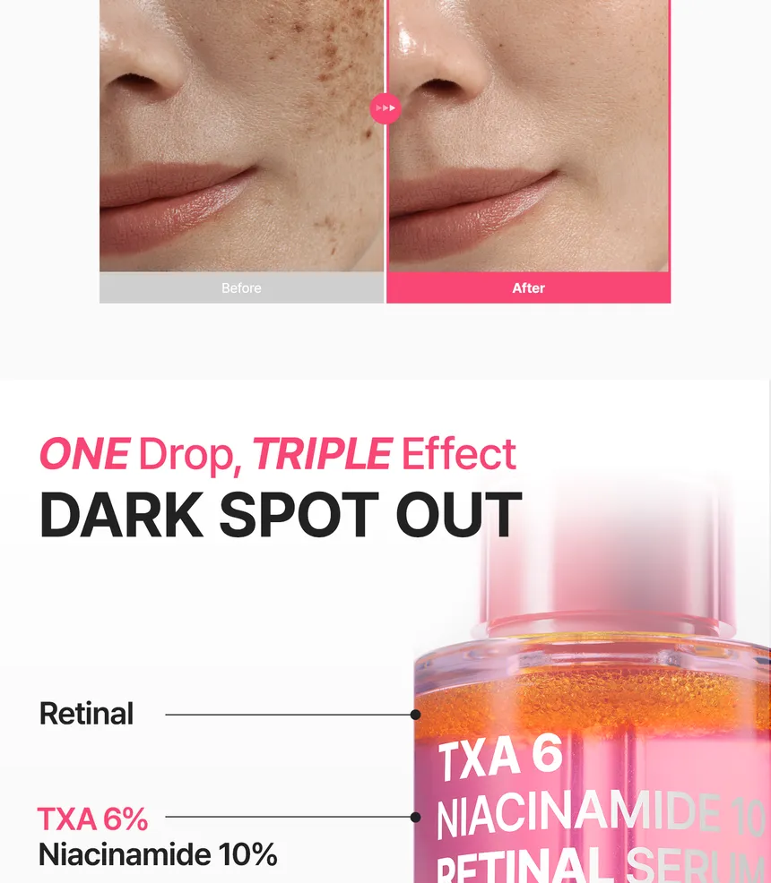 Purito Seoul Txa 6 Niacinamide 10 Retinal Serum 30Ml Buy Online At K-Beauty Shine Purito Seoul Txa 6 Niacinamide 10 Retinal Serum 30Ml